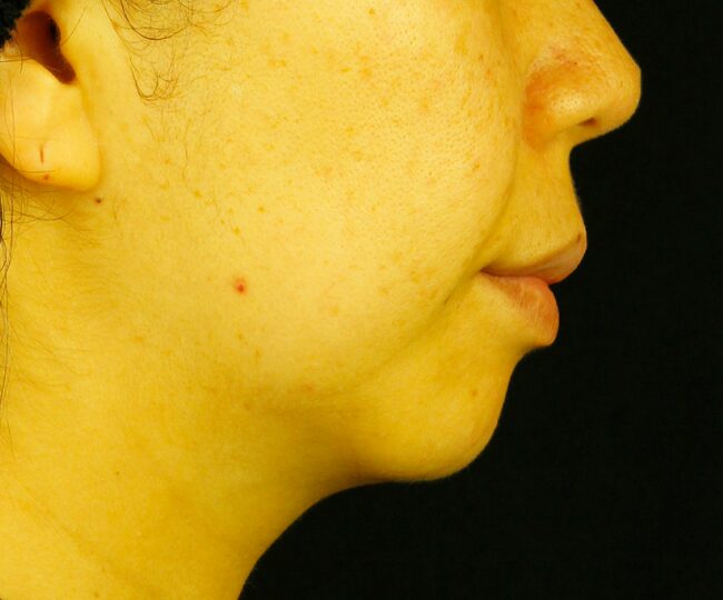 After