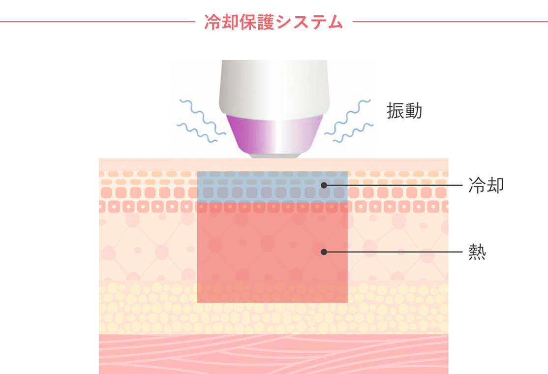 冷却保護時ステム