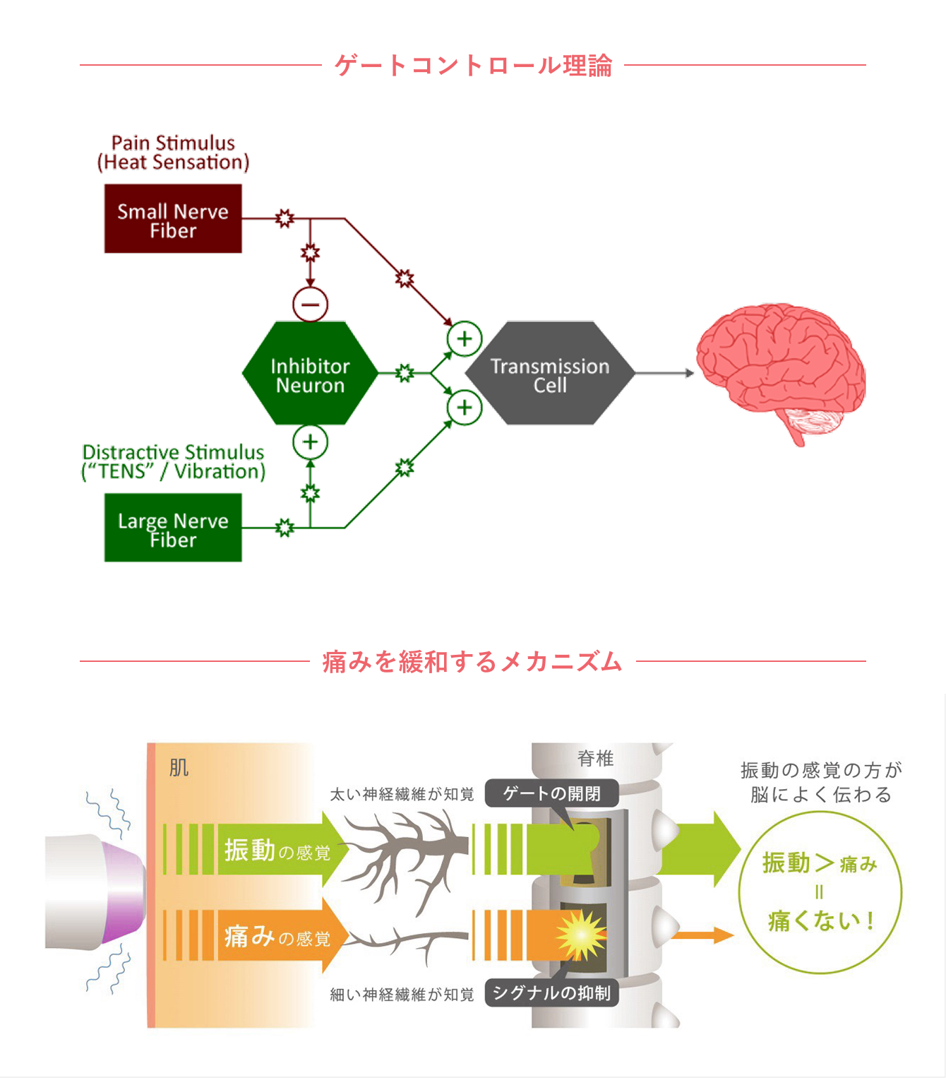 ゲートコントロール理論と痛みの少ないメカニズム