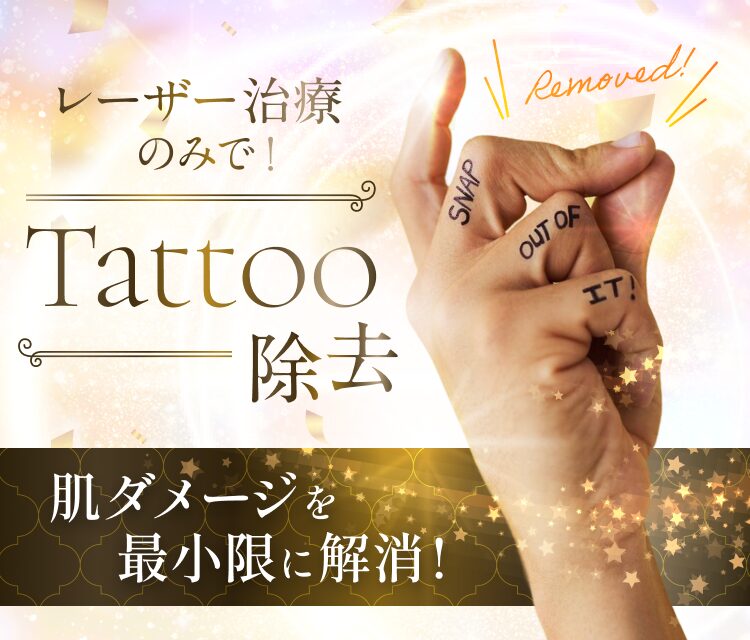 レーザー治療のみで！タトゥー除去