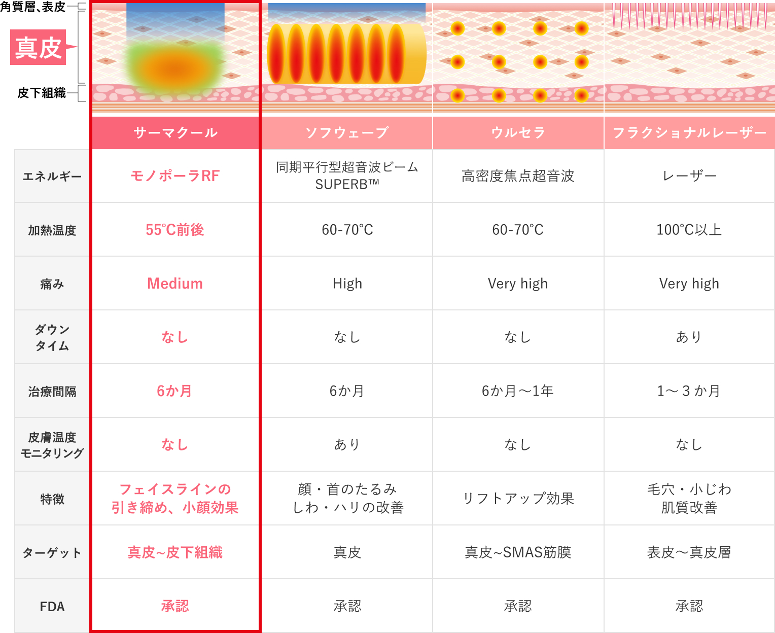 サーマクールFLX｜美容皮膚科シロノクリニック｜恵比寿院(東京都渋谷区)